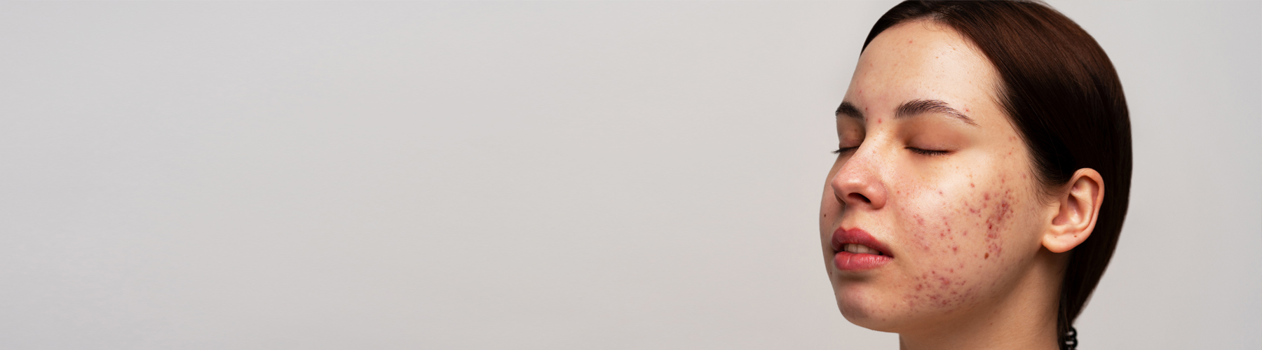Chronic Conditions